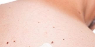 Ομιλία για το μελάνωμα και τον καρκίνο του δέρματος Ομιλία για το μελάνωμα και τον καρκίνο του δέρματος