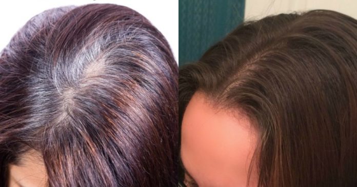 exafaniste-tis-gkrizes-triches-apo-ta-mallia-sas-me-ti-fysiki-syntagi-ton-dyo-systatikon