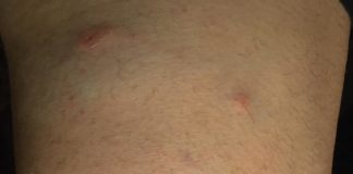 Καταγγελία σοκ: Ανάβαση στο βουνό πάνω από τον Χολαργό- Παπάγο