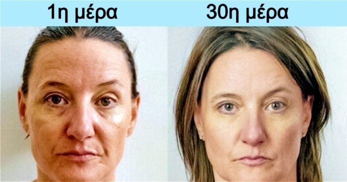 8-trofes-ploysies-se-kollagono-poy-omorfainoyn-to-derma-kai-dynamonoyn-tis-arthroseis-me-fysiko-tropo