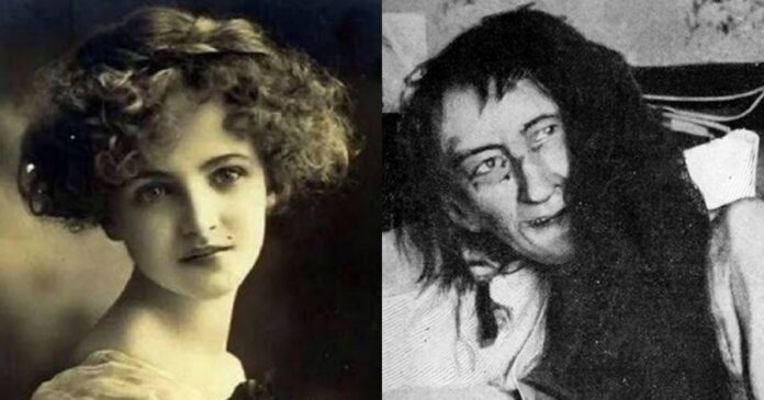 mia-gallida-emeine-kleismeni-sti-sofita-gia-25-chronia-giati-agapise-ton-lathos-antra-5